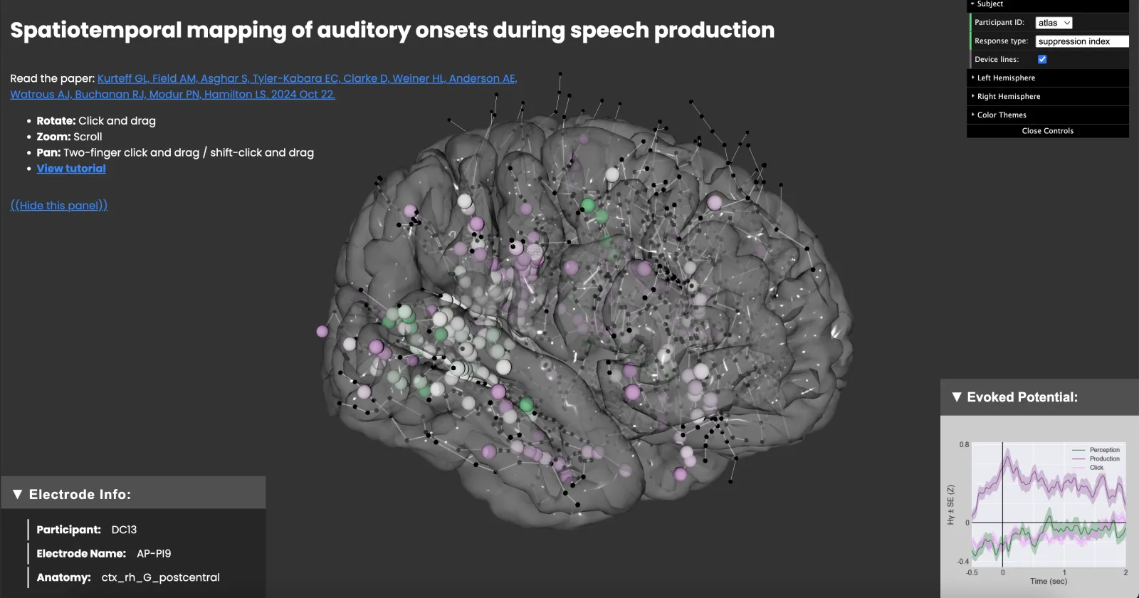 Screenshot of interactive brain viewer