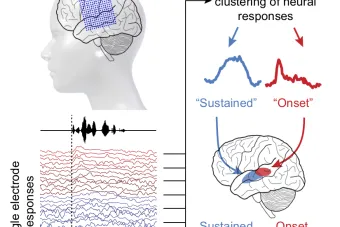 Graphical abstract showing schematic of electrocorticography recording setup, neural responses to speech, and unsupervised clustering of these neural responses to reveal a posterior onset and an anterior sustained area of superior temporal gyrus.