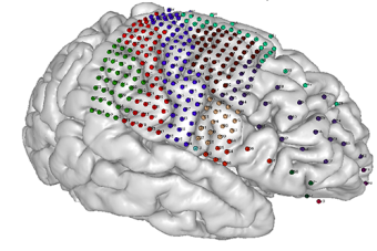 Picture of brain with electrodes localized and labeled using our software.
