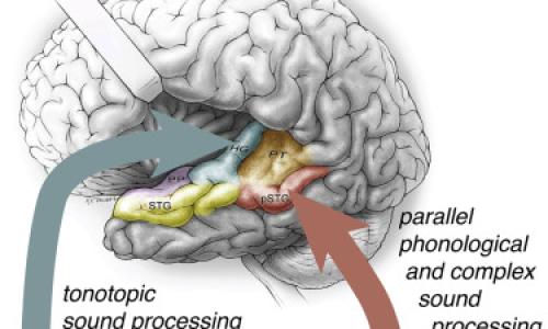 illustration of the auditory cortex of the human brain