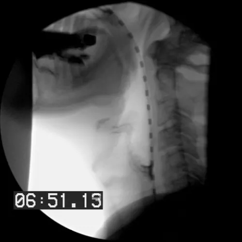 videofluoroscopy