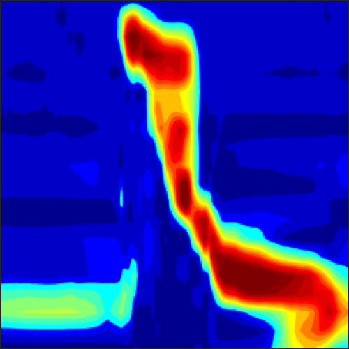 high-resolution manometry