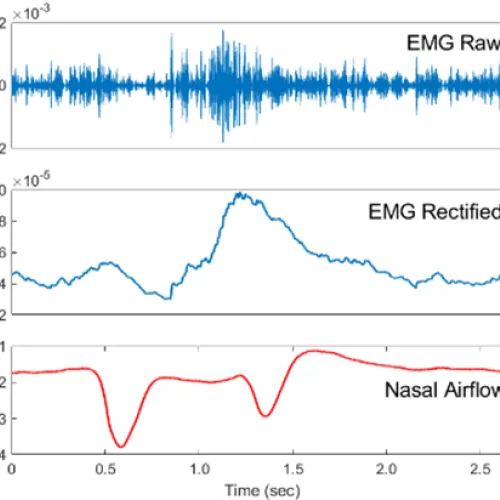 EMG